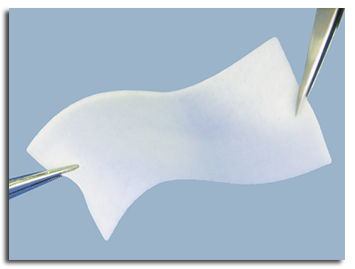 Proformix Tissue Matrix